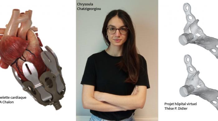 Implants biomimétiques, exosquelette cardiaque ou encore hôpital virtuel : voici quelques projets en lien avec la santé sur lesquels peuvent travailler les chercheurs du LEM3